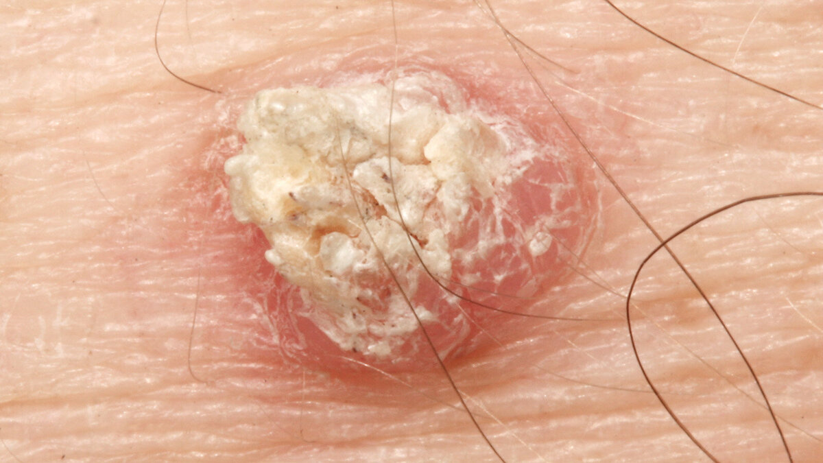 Foto: Dermatology11/Shutterstock.com