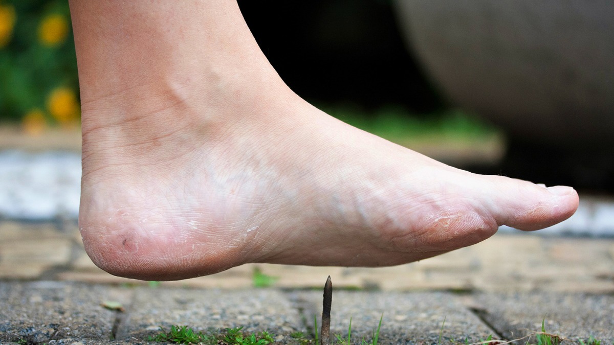 Menschen mit diabetischem Fußsyndrom spüren Schmerzen am Fuß nur noch minimal oder gar nicht mehr. Foto: Talita Nicolielo/Shutterstock.com