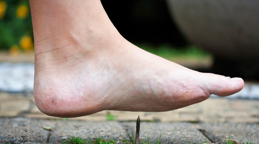Menschen mit diabetischem Fußsyndrom spüren Schmerzen am Fuß nur noch minimal oder gar nicht mehr. Foto: Talita Nicolielo/Shutterstock.com