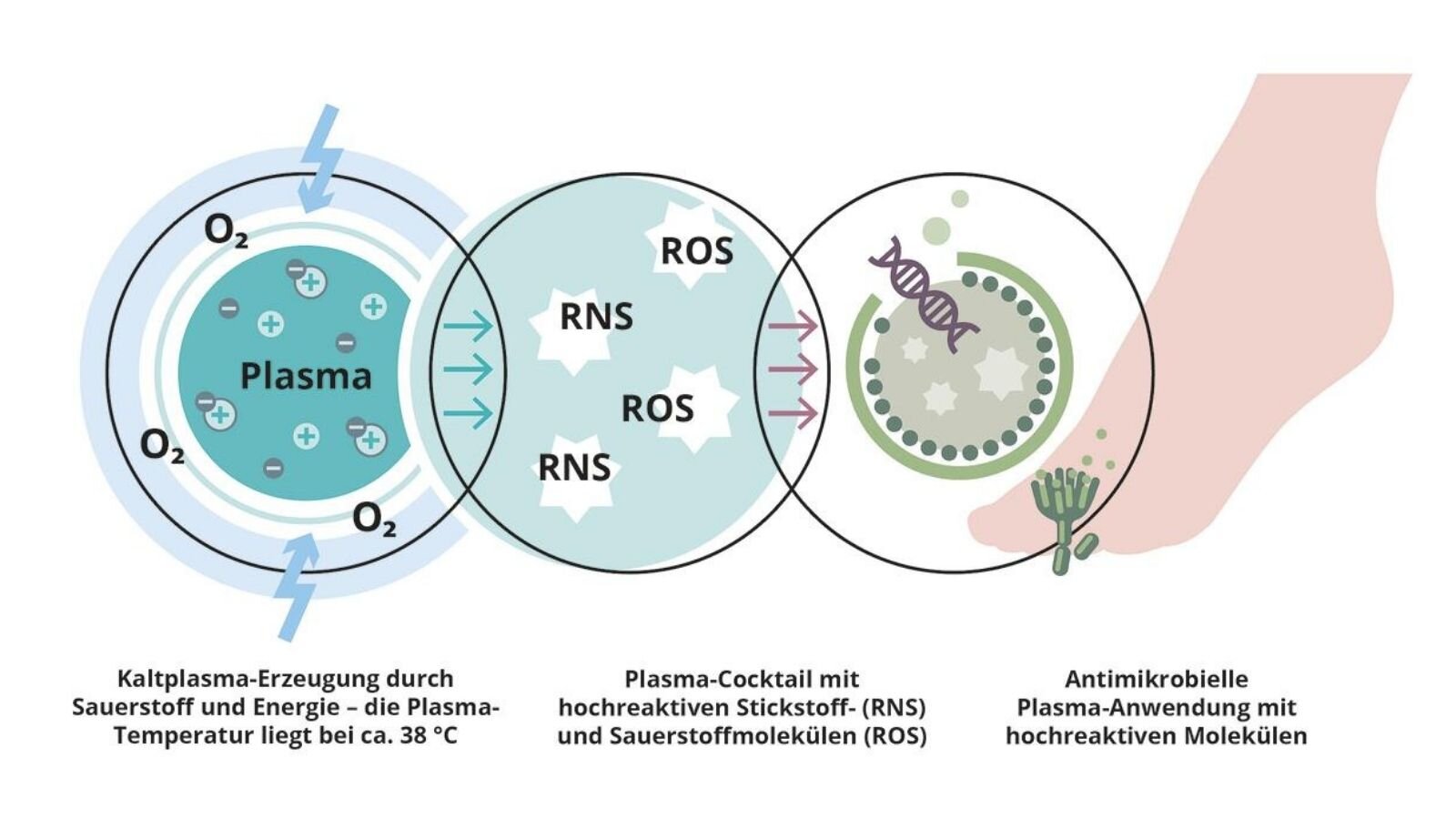 Antimykotische Wirkung von Kaltplasma durch ROS und RNS