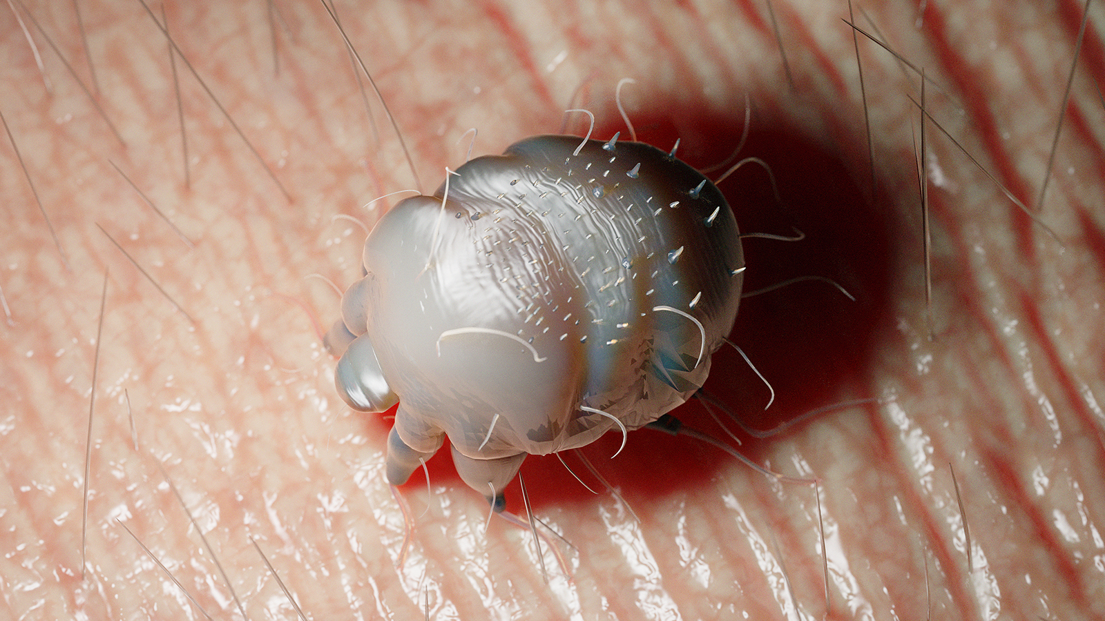 Krätze auf dem Vormarsch BEAUTY FORUM Deutschland