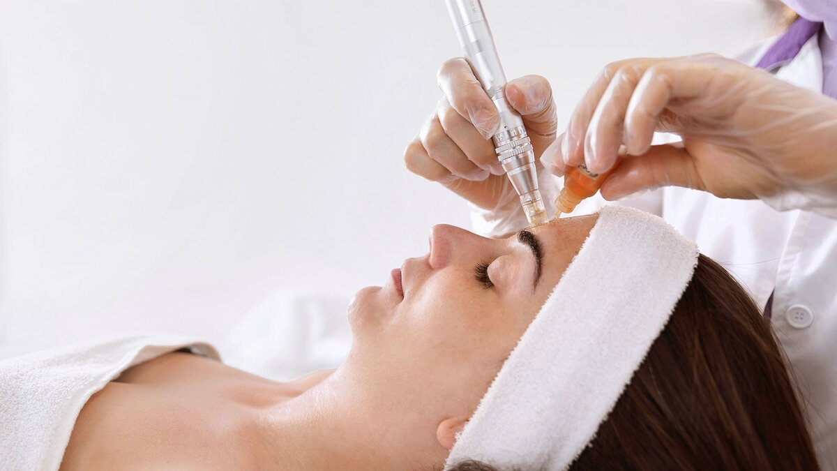 Microneedling – Kosmetik oder Heilkunde