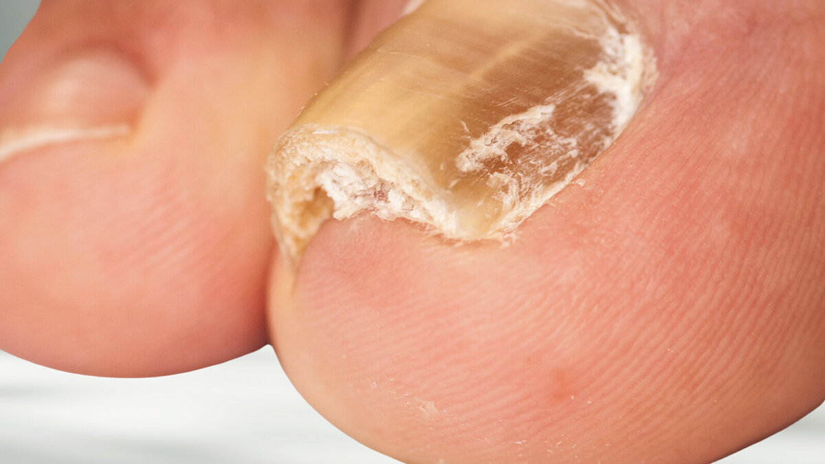 Foto: prabodha d herath/shutterstock.com