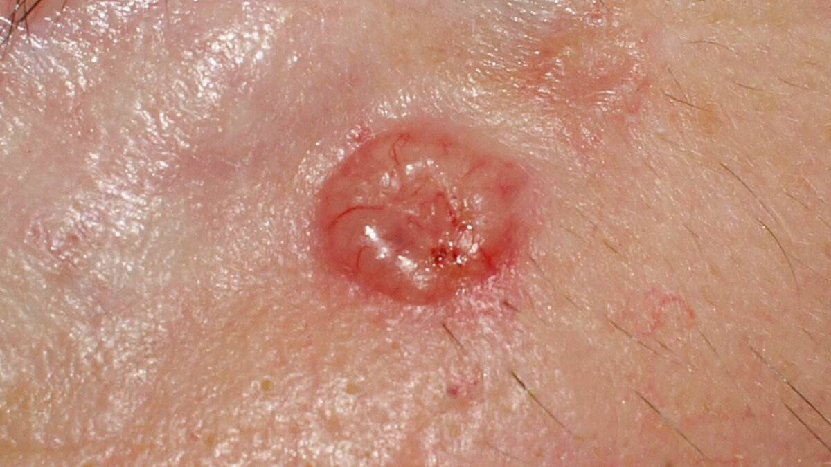 Foto: Dermatology11/Shutterstock.com