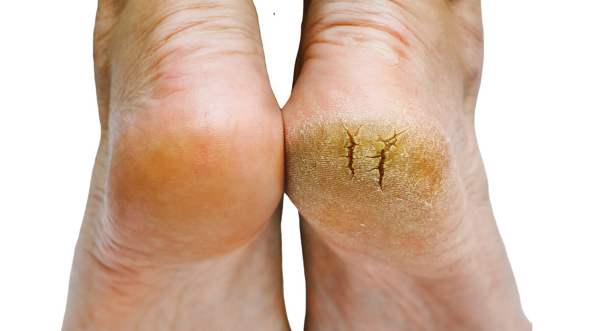 Foto: OlPhotoV/Shutterstock.com