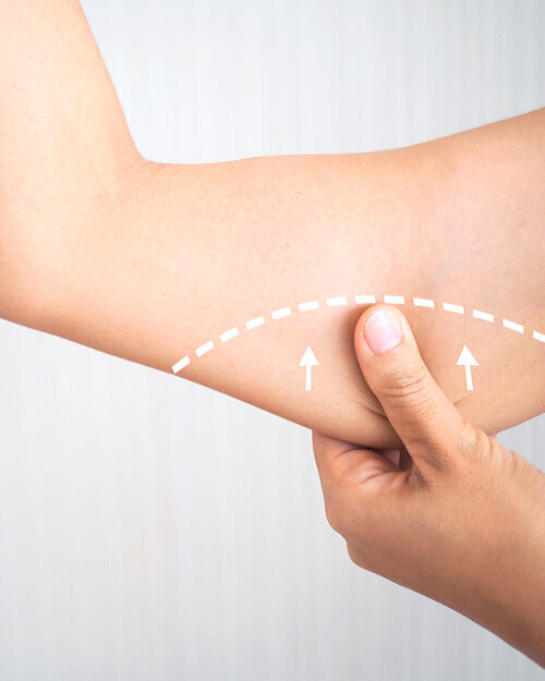 Foto: onstockphoto/Shutterstock.com