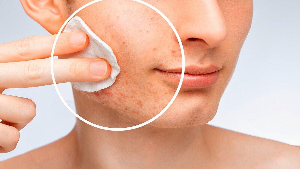 Foto: dimid_86/shutterstock.com