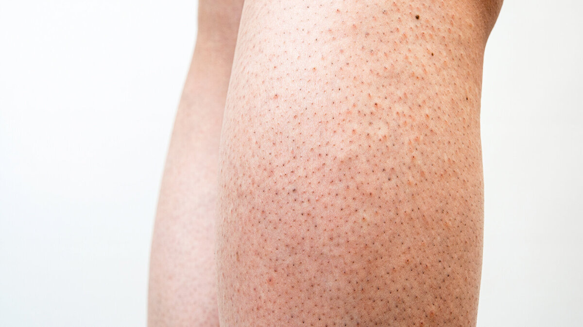 Foto: Taro_since2017/Shutterstock.com