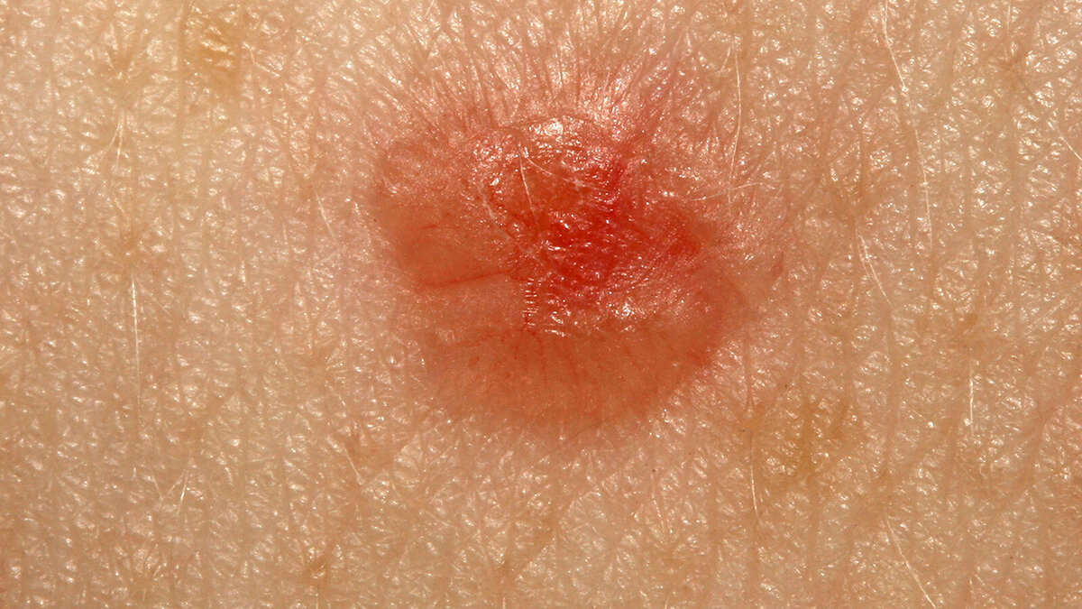 Foto: Peakstock/Shutterstock.com 