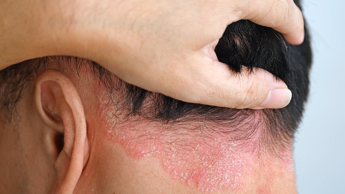 Foto: Dr. med. Christian Drerup