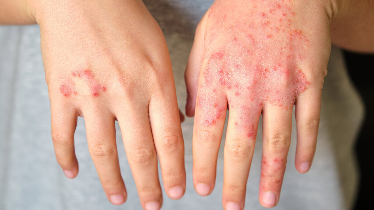 Foto: Ladanifer/Shutterstock.com