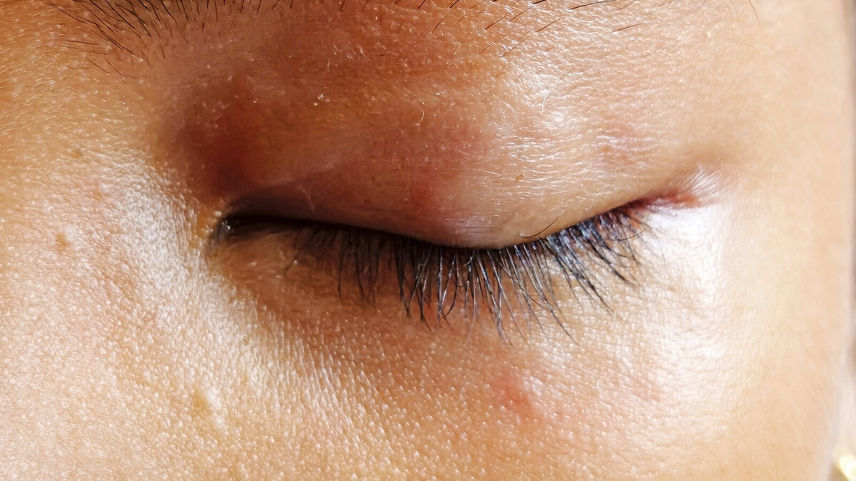 Foto: Dr. med. Christian Drerup