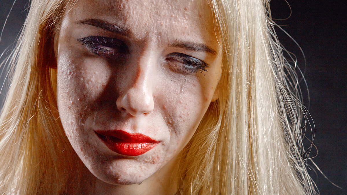 Wechselwirkung von Psyche und Haut BEAUTY FORUM Deutschland