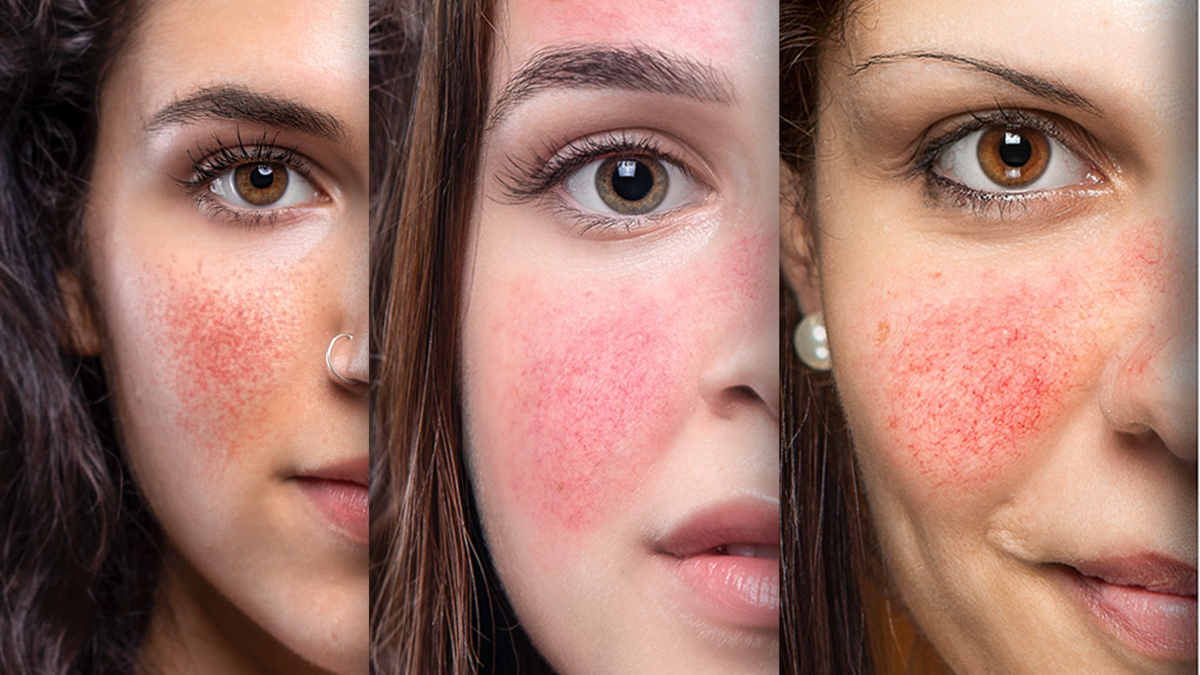 Foto: sruilk/Shutterstock.com