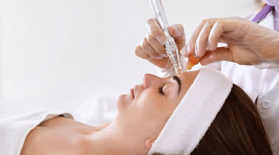 Microneedling – Kosmetik oder Heilkunde