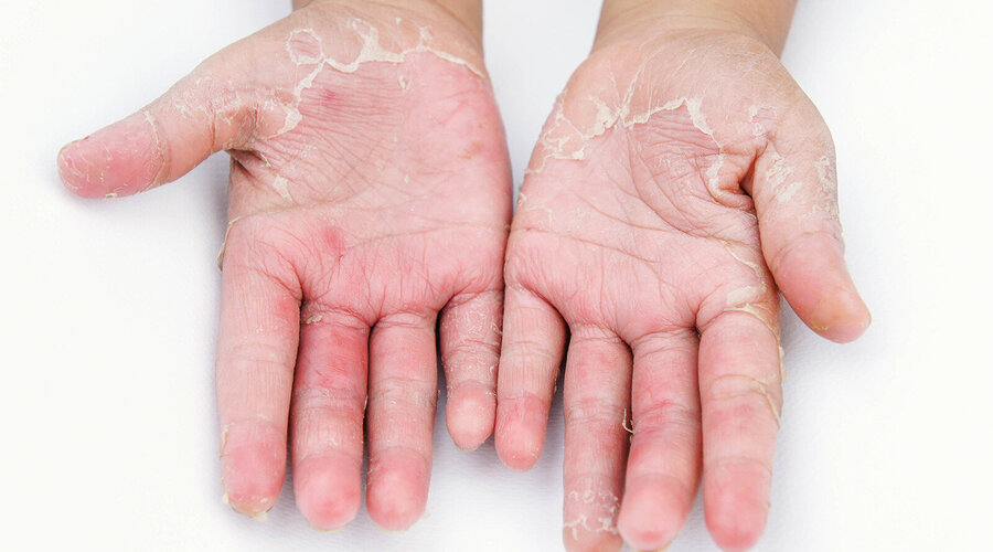 Foto: girl-think-position/Shutterstock.com