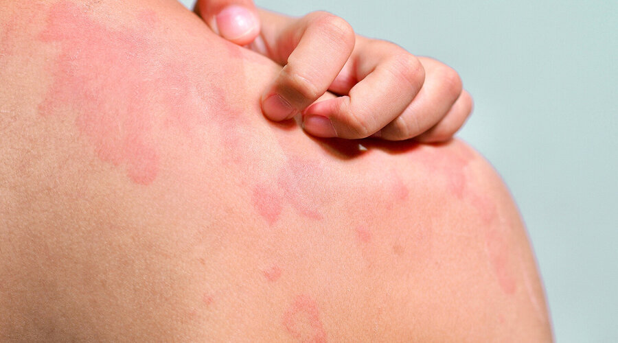 Foto: TANAPAT LEK.JIW/Shutterstock.com