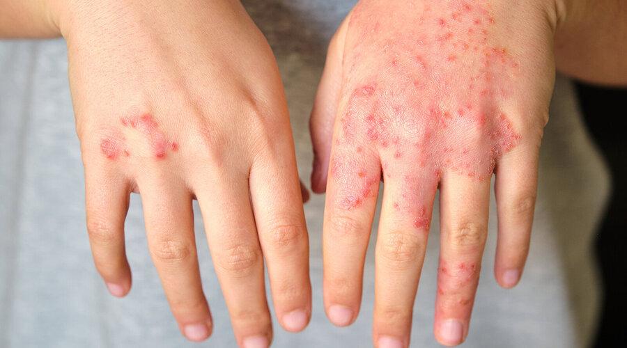 Foto: Ladanifer/Shutterstock.com