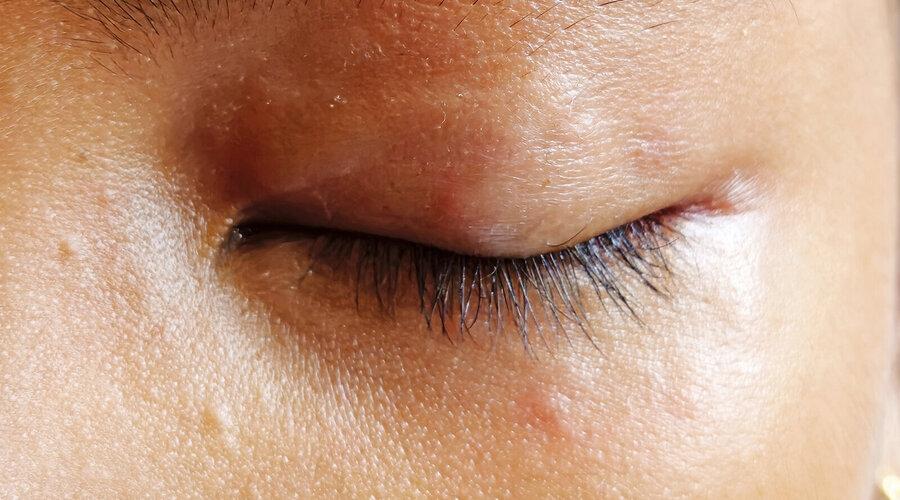 Foto: Dr. med. Christian Drerup