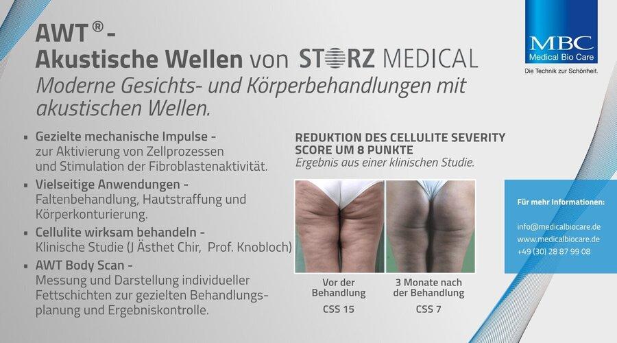 AWT® von STORZ MEDICAL