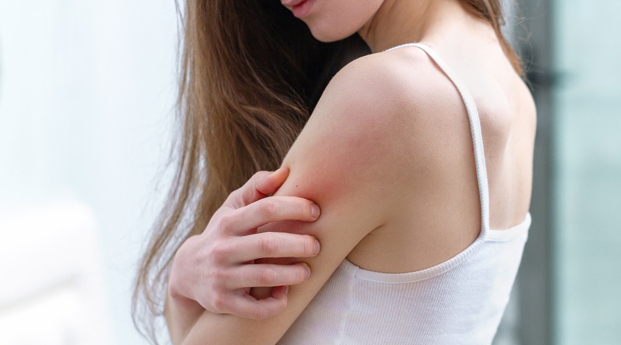 Pruritus gilt als Leitsymptom vieler dermatologischer Erkrankungen. Fotos: goffkein/Shutterstock.com, Autorin