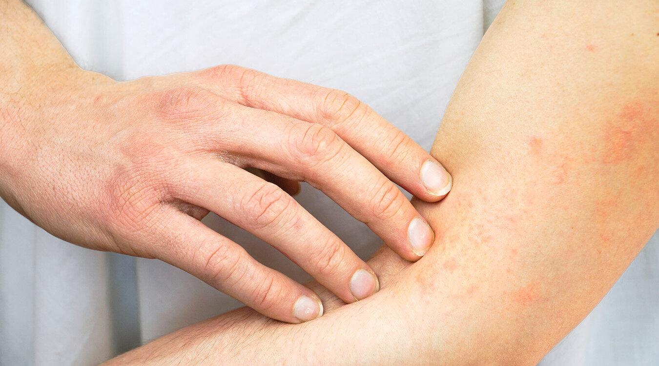 Foto: Georg Brandt LE