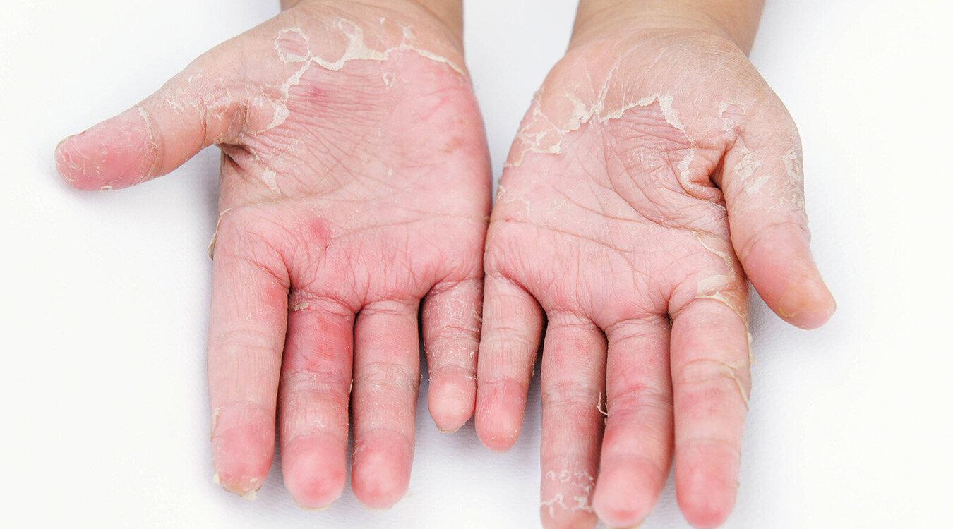 Foto: girl-think-position/Shutterstock.com