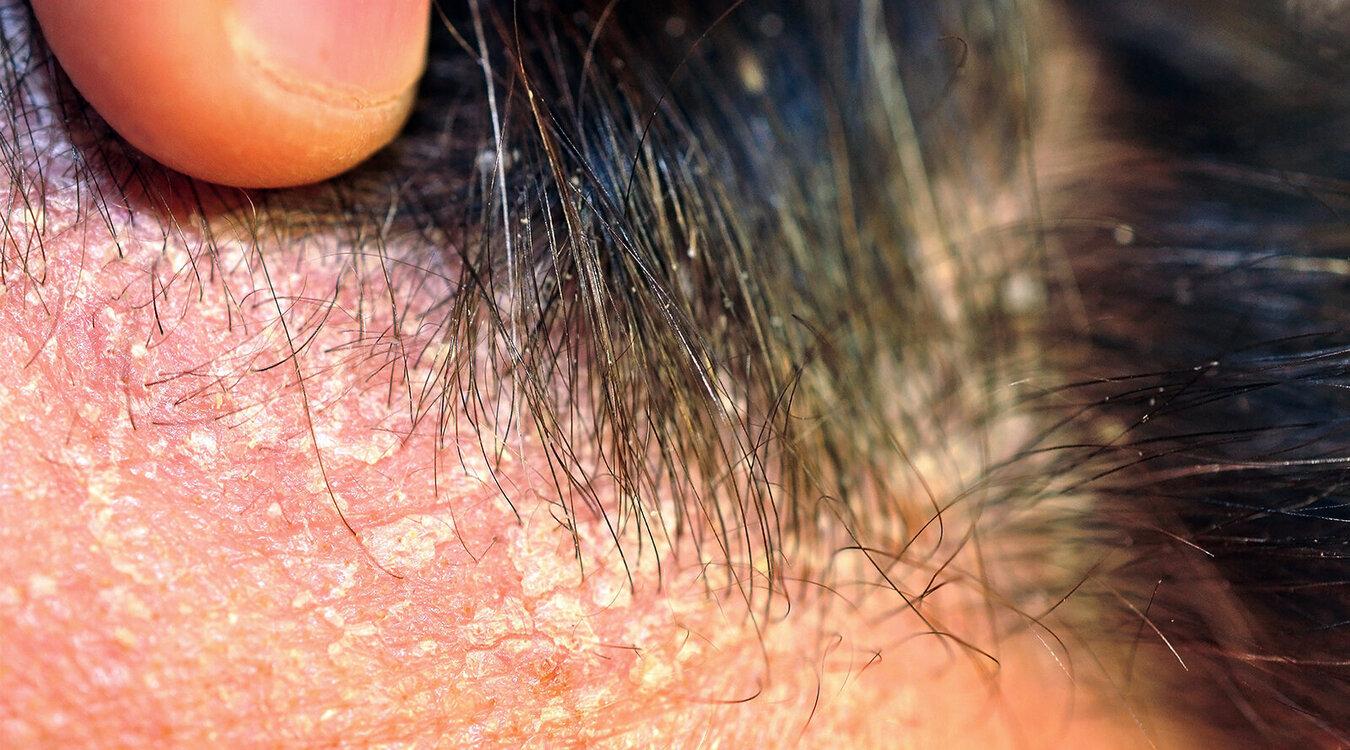 Foto: Meryll/shutterstock.com