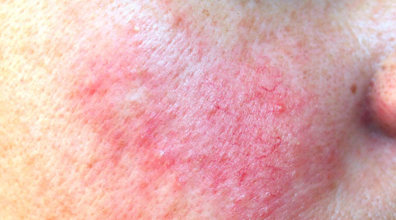 Foto: Dermatology11/Shutterstock.com