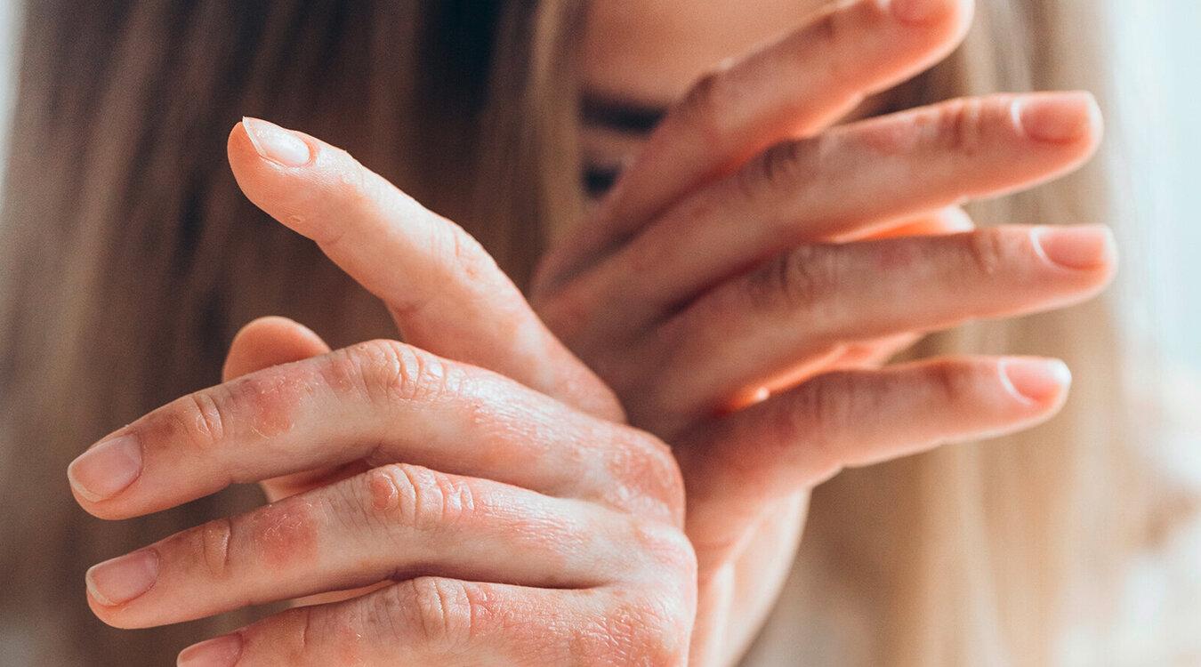 Foto: Nina Buday/Shutterstock.com