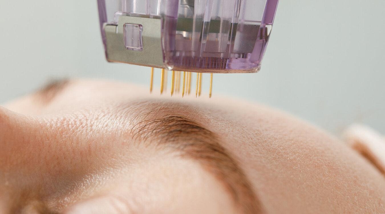 Foto: Aleksandr Rybalko/Shutterstock.com