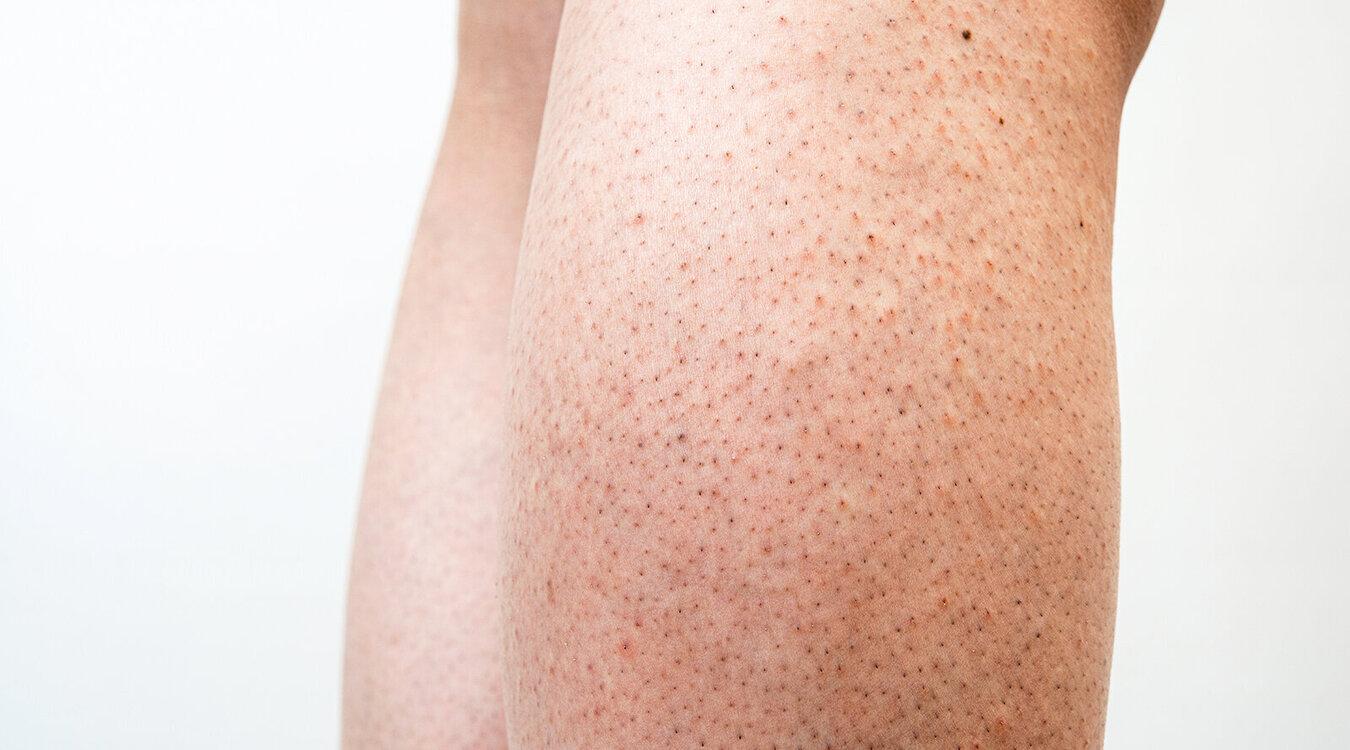 Foto: Taro_since2017/Shutterstock.com