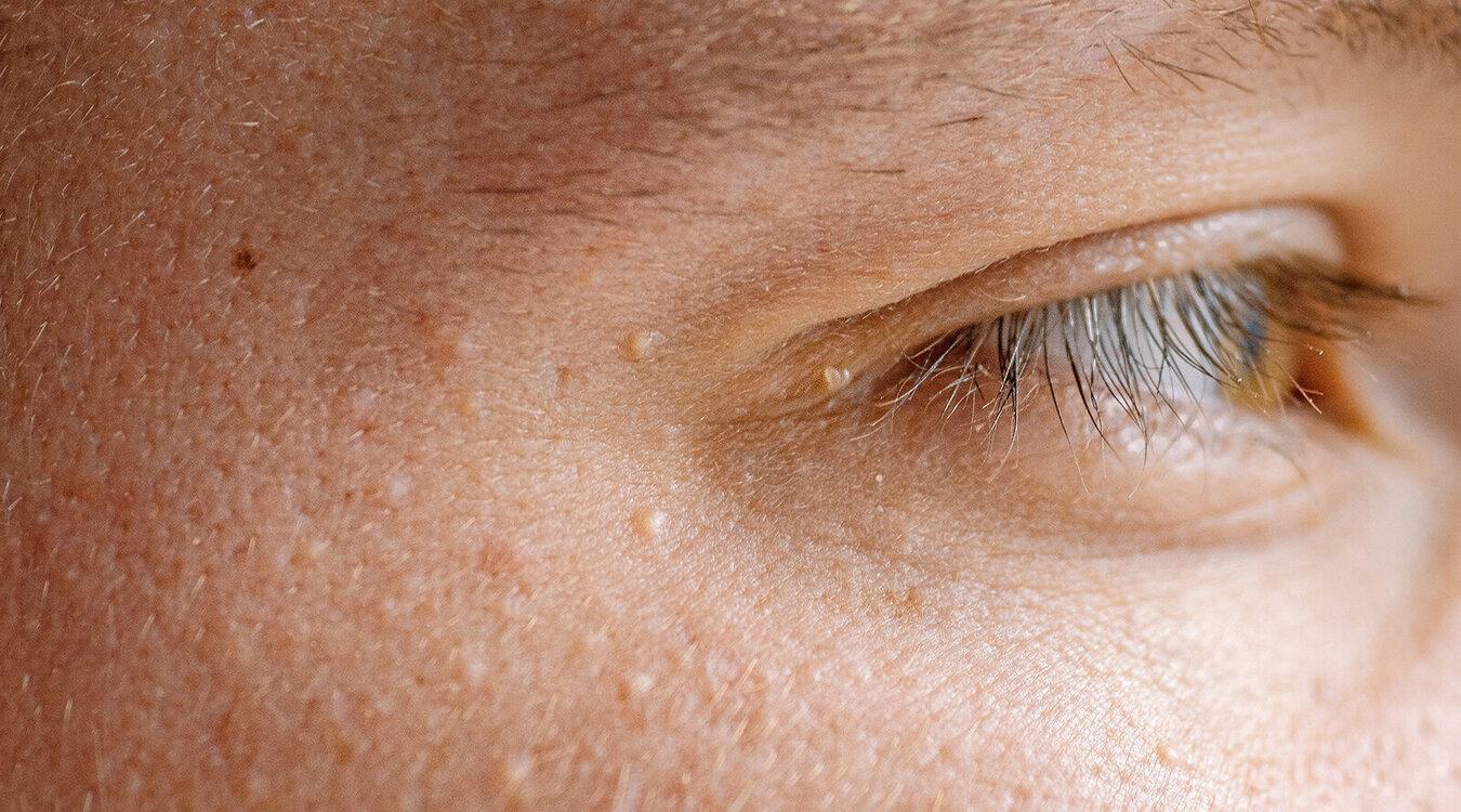 Foto: Dr. med. Christian Drerup