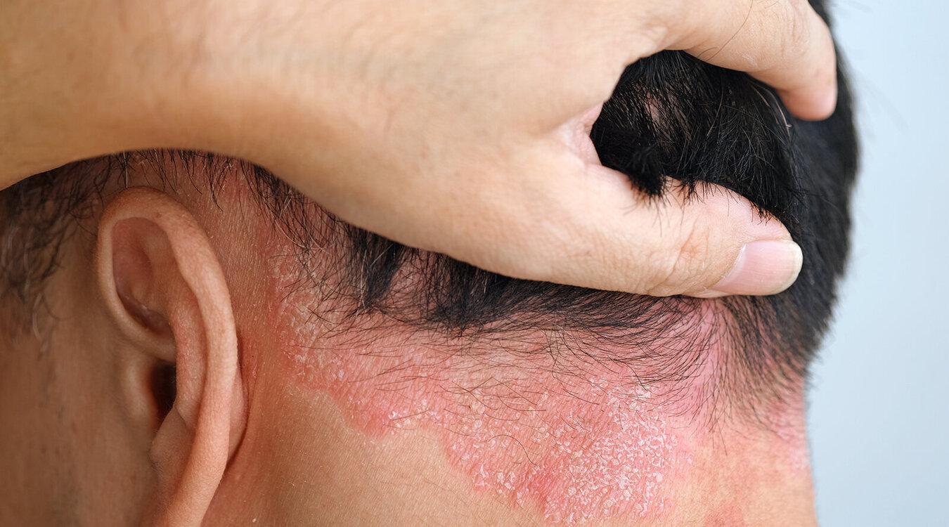 Foto: Dr. med. Christian Drerup