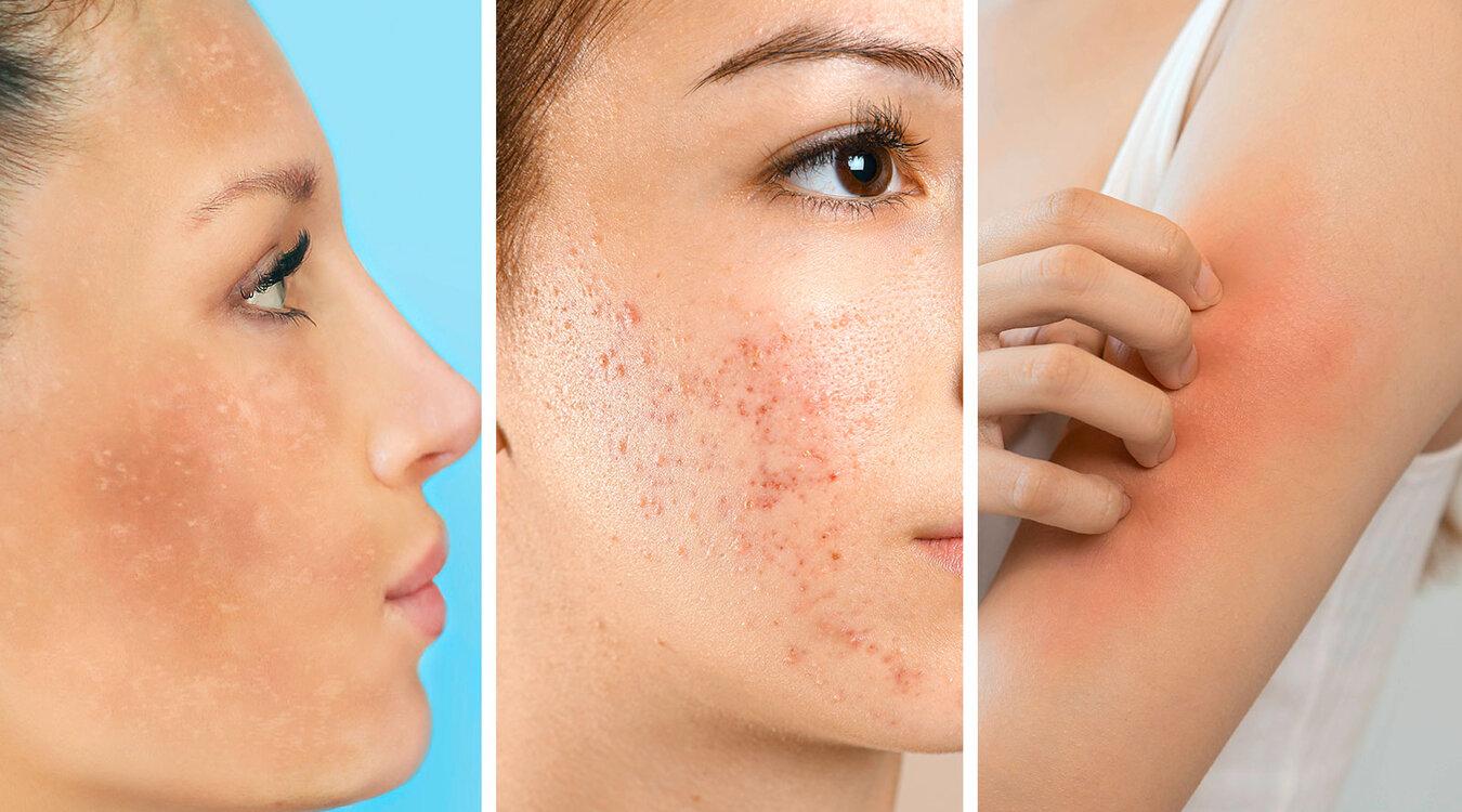 Fotos: Kmpzzz, New Africa, LADO/Shutterstock.com